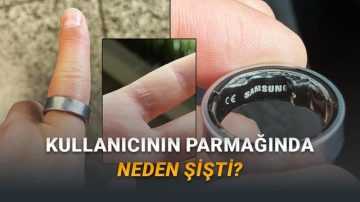 Galaxy Ring’in Aylar Evvel Bir Kullanıcının Parmağında Şişmesinin Sebebi Aşikâr Oldu (Kullanmak İnançlı mi?)